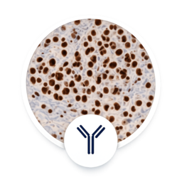 Inmunohistoquímica